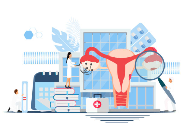 illustration endométriose