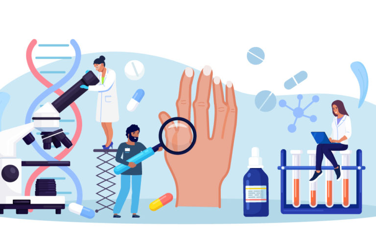 illustration syndrôme marfan illustration syndrôme marfan