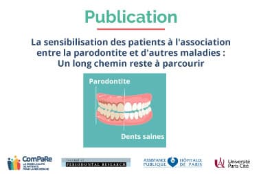 image d’illustration parodontite image d'illustration parodontite